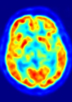Immagine tomografica cervello