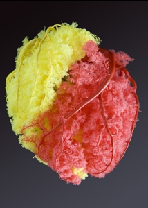 Immagine stilizzata arterie coronarie