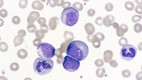 Immagine stilizzata cellule tumorali