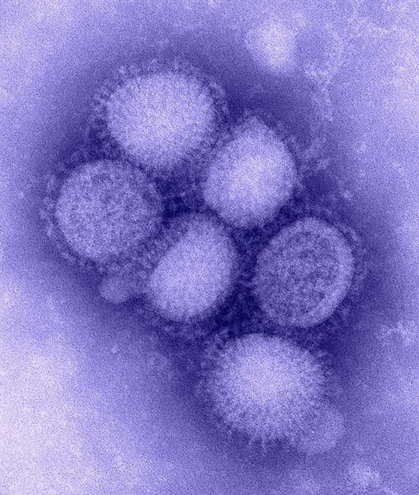 Influenzavirus A sottotipo H1N1 visto al microscopio