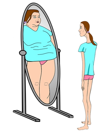 Rappresentazione dell'anoressia